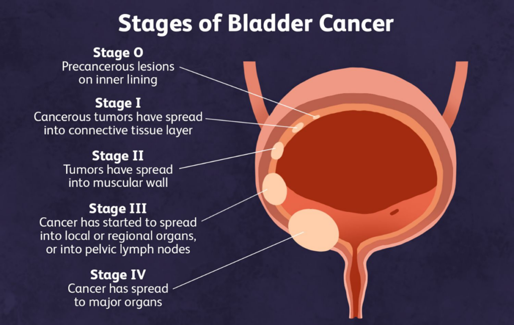 Best urologist for bladder problems in Mumbai