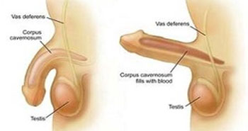 Erectile Dysfunction Treatment In mumbai