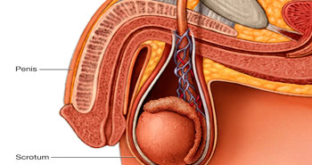Varicocele causes and treatments by  leading Urologist in Mumbai