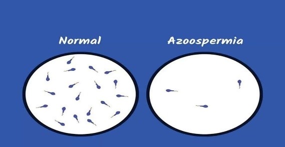 Best Andrologist for male infertility in mumbai