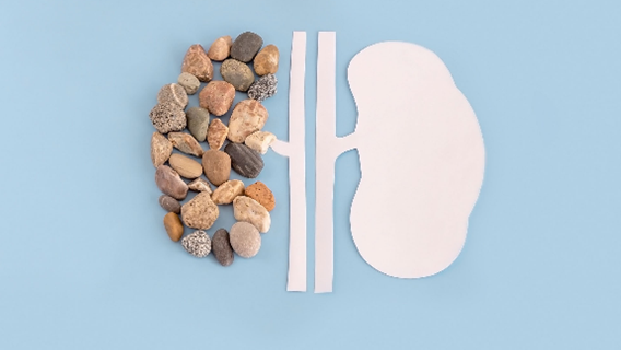 Best Kidney stone Doctor in Mumbai -Types of kidney stone