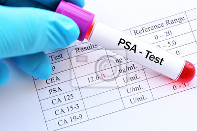 Test for detecting prosate cancer Explained by Best prostate cancer in Mumbai