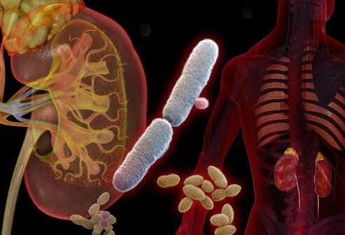 UTI Urinary Tract Infection treatment  in mumbai 